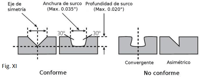 Figura XI